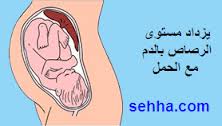 التسمم بالرصاص